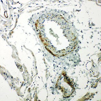 Caveolin-2/CAV2 Rabbit Polyclonal Antibody