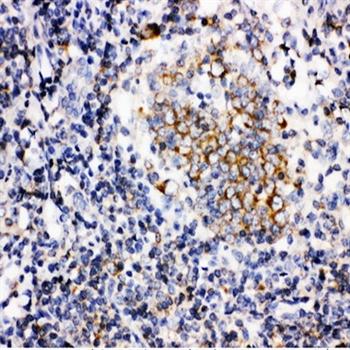 BAFF/TNFSF13B Rabbit Polyclonal Antibody