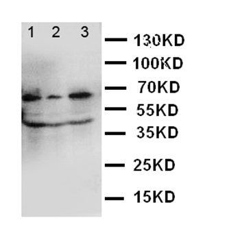 Guanylate-binding protein 1 GBP1 Rabbit Polyclonal Antibody