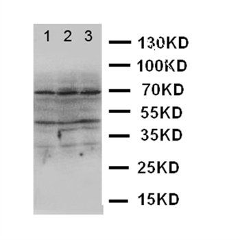 DAP Kinase 2/DAPK2 Rabbit Polyclonal Antibody