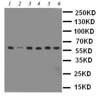 PAK1 Rabbit Polyclonal Antibody