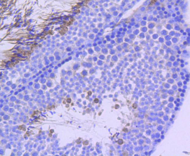 p95/NBS1 (Phospho-S343) Rabbit mAb Antibody