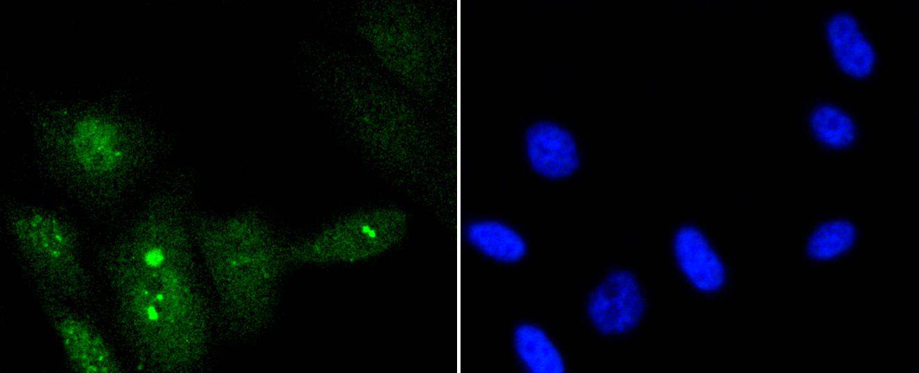 p95/NBS1 (Phospho-S343) Rabbit mAb Antibody