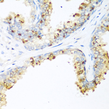 LRP5 polyclonal antibody