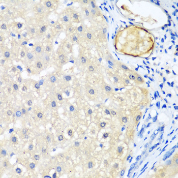 LRP5 polyclonal antibody