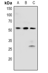 BRK (Phospho-Y342) polyclonal antibody