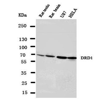 Dopamine Receptor D1/DRD1 Rabbit Polyclonal Antibody