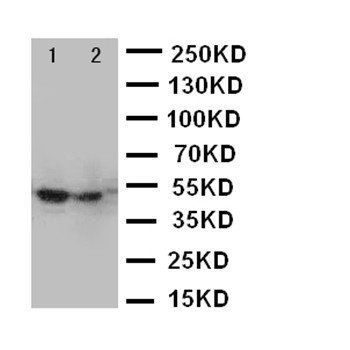 Forkhead box protein P3 FOXP3 Rabbit Polyclonal Antibody