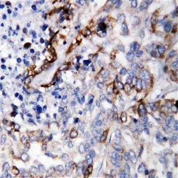 Laminin subunit gamma-2 LAMC2 Rabbit Polyclonal Antibody