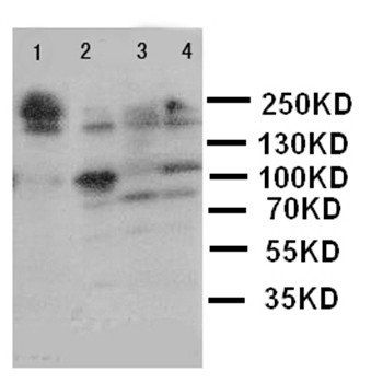 Laminin subunit gamma-2 LAMC2 Rabbit Polyclonal Antibody