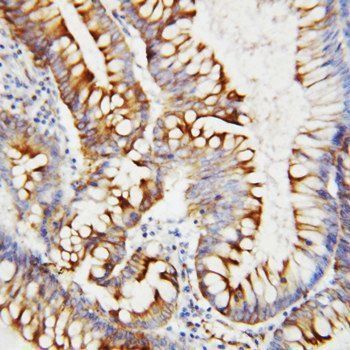 SPARC Rabbit Polyclonal Antibody