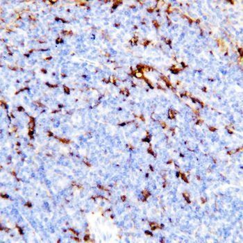TREM1 Rabbit Polyclonal Antibody