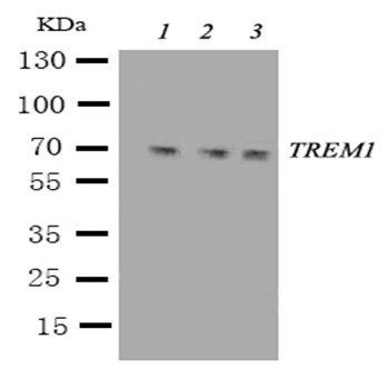 TREM1 Rabbit Polyclonal Antibody