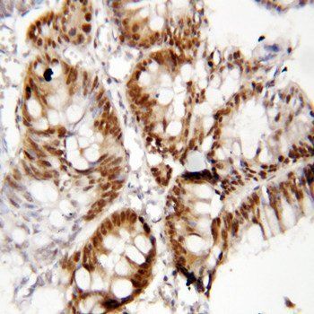 Forkhead box protein P1 FOXP1 Rabbit Polyclonal Antibody