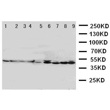 HDJ2/DNAJA1 Rabbit Polyclonal Antibody