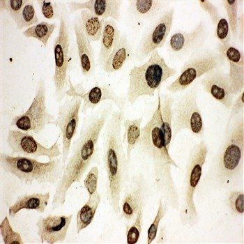 Homeobox protein Hox-A4 HOXA4/A4 Rabbit Polyclonal Antibody