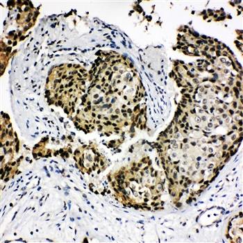 Homeobox protein Hox-A4 HOXA4/A4 Rabbit Polyclonal Antibody