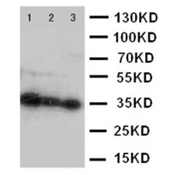 Homeobox protein Hox-A4 HOXA4/A4 Rabbit Polyclonal Antibody