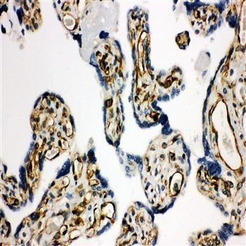 HSD17B2 Rabbit Polyclonal Antibody