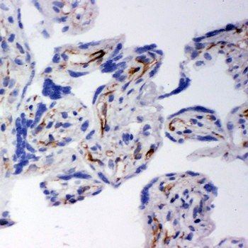 HSD17B2 Rabbit Polyclonal Antibody