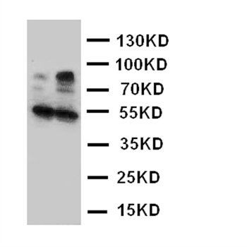 HSD17B2 Rabbit Polyclonal Antibody