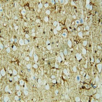 Heat shock factor protein 2 HSF2 Rabbit Polyclonal Antibody