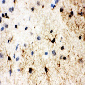 Heat shock factor protein 2 HSF2 Rabbit Polyclonal Antibody