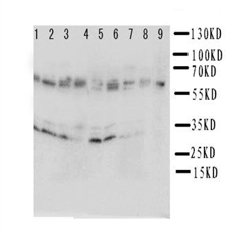 IL5RA Antibody