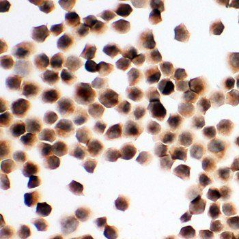 TIM 1/HAVCR1 Rabbit Polyclonal Antibody