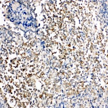 TIM 1/HAVCR1 Rabbit Polyclonal Antibody