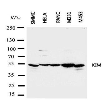 TIM 1/HAVCR1 Rabbit Polyclonal Antibody