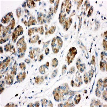 Kallikrein 1/KLK1 Rabbit Polyclonal Antibody