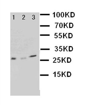 Kallikrein 1/KLK1 Rabbit Polyclonal Antibody