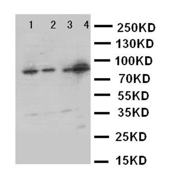 Integrin beta 3/ITGB3 Rabbit Polyclonal Antibody