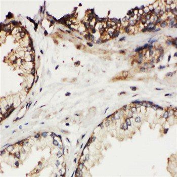 Kallikrein 11/KLK11 Rabbit Polyclonal Antibody