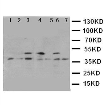 Kallikrein 11/KLK11 Rabbit Polyclonal Antibody
