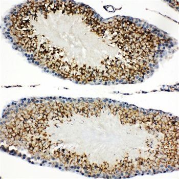 TIM 1/HAVCR1 Rabbit Polyclonal Antibody