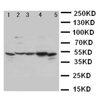 TIM 1/HAVCR1 Rabbit Polyclonal Antibody