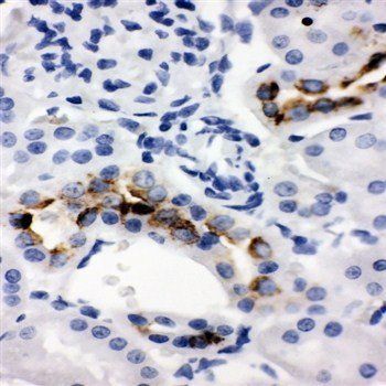 Kallikrein 1/Ngfg Rabbit Polyclonal Antibody