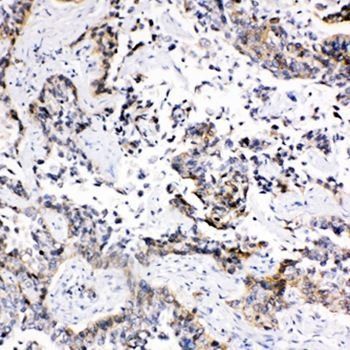 MRP1/ABCC1 Rabbit Polyclonal Antibody