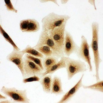 Bub3 Rabbit Polyclonal Antibody