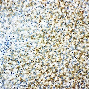 Monoamine Oxidase B/MAOB Rabbit Polyclonal Antibody
