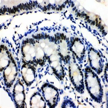 MCM3 Rabbit Polyclonal Antibody