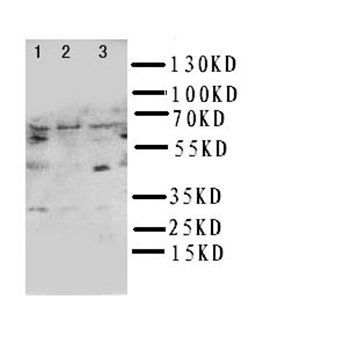 NUR77/NR4A1 Rabbit Polyclonal Antibody