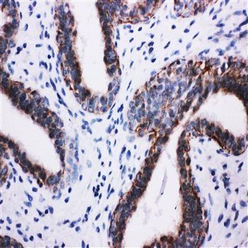 PI 3 Kinase p85 beta/PIK3R2 Rabbit Polyclonal Antibody