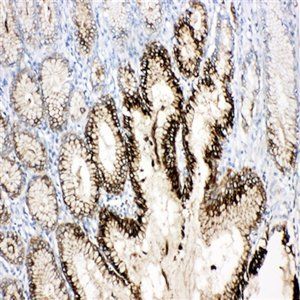 Estrogen Inducible Protein pS2/TFF1 Rabbit Polyclonal Antibody