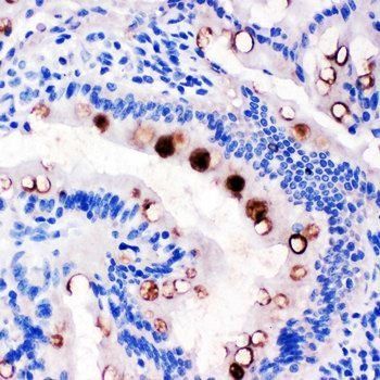 Estrogen Inducible Protein pS2/TFF1 Rabbit Polyclonal Antibody