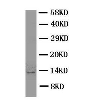 Estrogen Inducible Protein pS2/TFF1 Rabbit Polyclonal Antibody