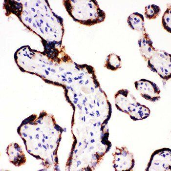 CYP11A1 Rabbit Polyclonal Antibody