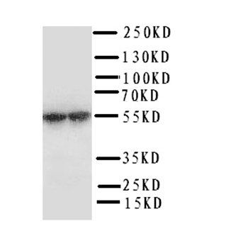 CYP11A1 Rabbit Polyclonal Antibody